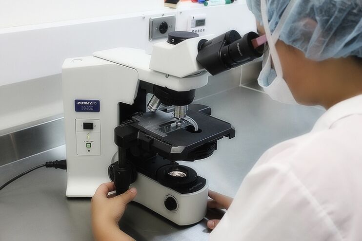 Examen histológico de tejidos de papiloma para detectar la presencia de células malignas. 