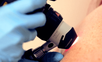Métodos de diagnóstico para la verruga plantar