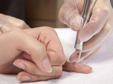 Realización de terapia con láser.