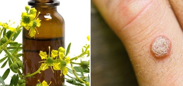tratamiento de verrugas con celidonia farmacéutica